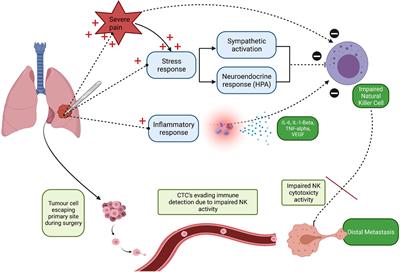 Can Acute Postoperative Pain Management After Tumour Resection Surgery Modulate Risk of Later Recurrence or Metastasis?